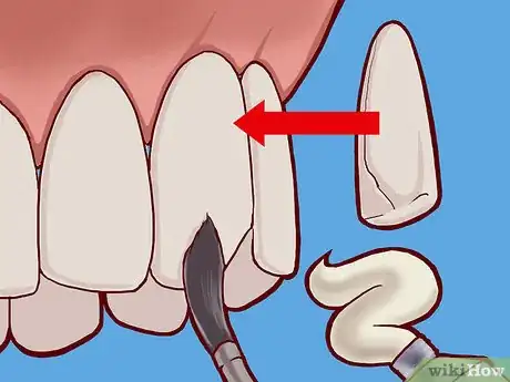 Image titled Strengthen Tooth Enamel Step 6