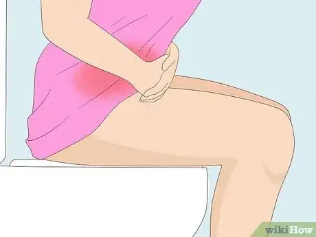Image titled Recognize Vulva Cancer Symptoms Step 9