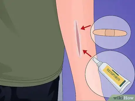 Image titled Make a Quick Disinfectant for Minor Cuts and Abrasions Step 9