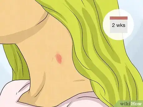 Image titled Identify a Hickey Step 6