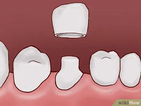 Image titled Strengthen Tooth Enamel Step 8