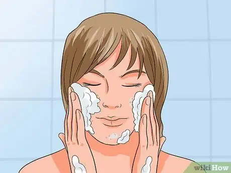 Image titled Get Rid of Acne Blemishes Step 3