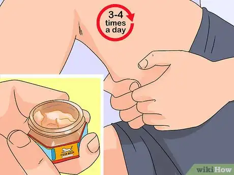 Image titled Use Tiger Balm Step 4