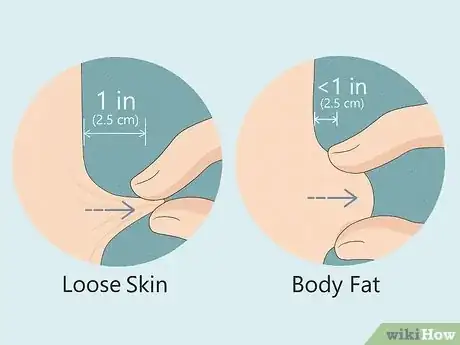 Image titled Tell the Difference Between Fat and Loose Skin Step 2