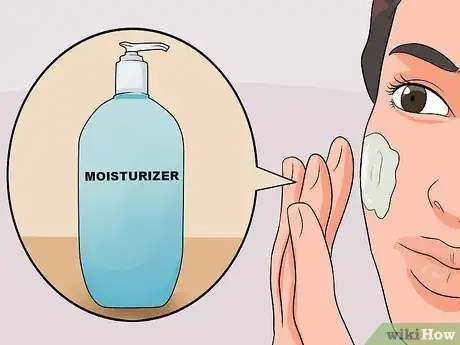 Image titled Get Rid of Acne Blemishes Step 5