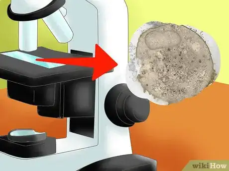 Image titled Tell the Difference Between Prokaryotes and Eukaryotes Step 5