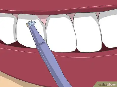 Image titled Apply Tooth Gems Step 13