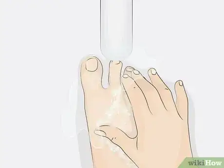 Image titled Cure Onycholysis Step 11