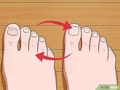 Image titled Prevent Nail Fungus Step 13