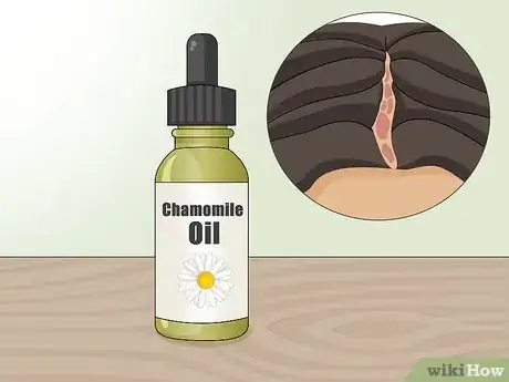 Image titled Use Essential Oils to Prevent an Itchy Scalp Step 3