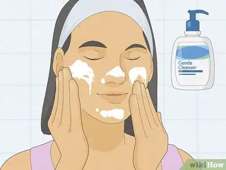 Image titled Get Rid of Oily Skin Fast Step 2