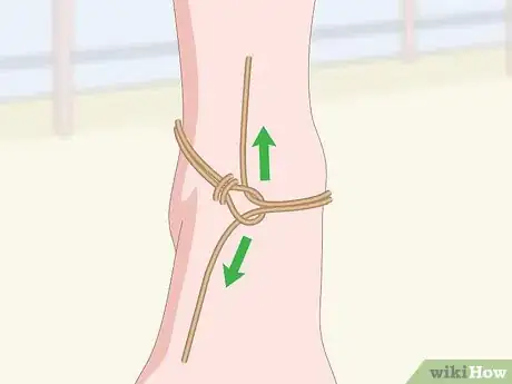 Image titled Tie an Anklet Step 10