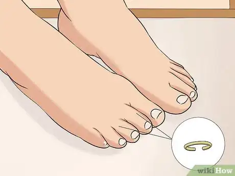 Image titled Wear Toe Rings Step 1