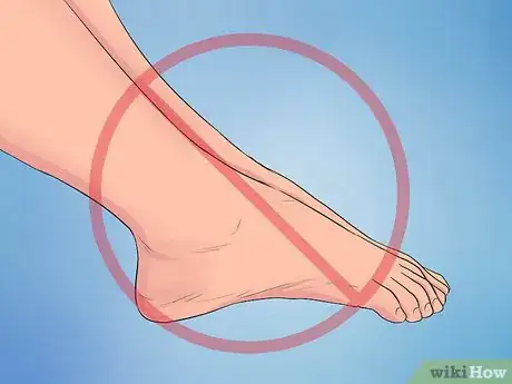 Image titled Treat Plantar Fasciitis Step 14