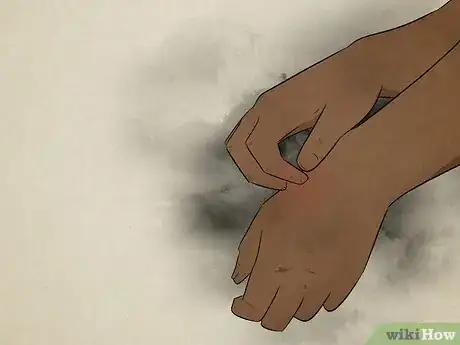 Image titled What Does It Mean when Your Left Hand Itches Step 1