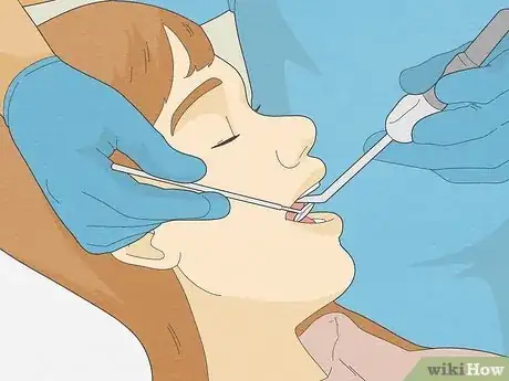 Image titled Brush Your Teeth With Braces On Step 16