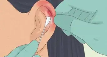 Heal Cartilage Piercing Bumps
