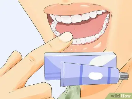 Image titled Get Rid of White Spots on Teeth Step 10