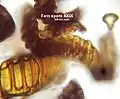 Dehisced fern sporangia. (microscopic view, no spores are visible)