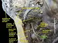 Lingual nerve