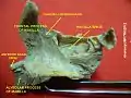 Frontal process of maxilla