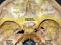 Close-up photo. Lesser wings of the sphenoid colored in yellow.