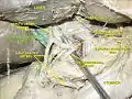 Common hepatic duct