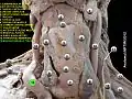 Brachiocephalic artery
