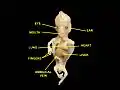 Human embryo, 38&nbsp;mm, 8–9 weeks–anterior view, heart is visible.