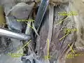 Trochlear nerve.Deep dissection.Superior view.