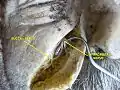 Infaorbital and buccal nerve.Superficial dissection.Lateral view.