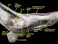 Ankle joint. Deep dissection. Medial view