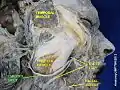 Parotid duct