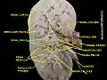 Renal sinus