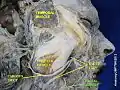 Facial artery
