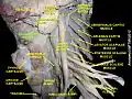 Longus capitis muscle