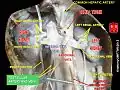 Testicular vein