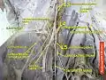 Iliac crest