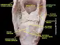Aryepiglottic fold