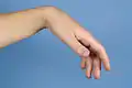 Wrist flexion tenodesis effect