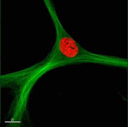 GFP fusion proteins