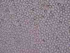Urinalysis