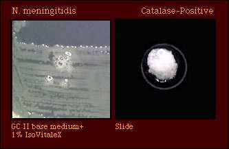catalase