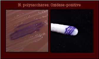 oxidase