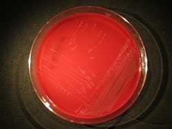 image of Capnocytophaga plate