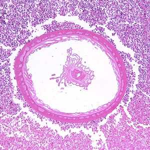 Figure C