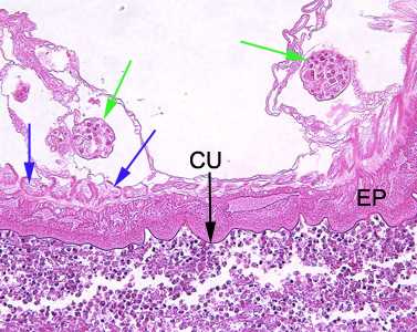 Figure B