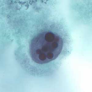 	Figure C
