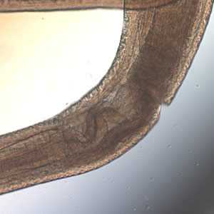 Figure E