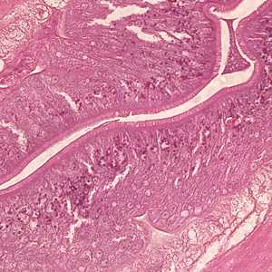 Figure C
